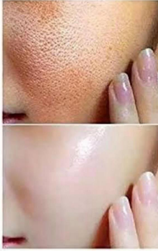 Gluta White Day & Night Cream 100% Natural Whitening Anti-Aging