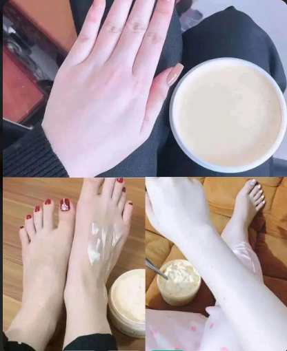Whitening Cream for All Skin Types