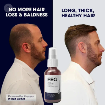 FEG Hair Growth Spray for Scalp & Hair Density