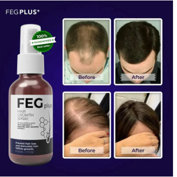 FEG Hair Growth Spray for Scalp & Hair Density