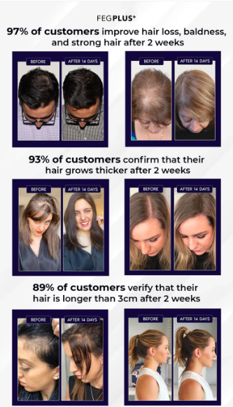 FEG Hair Growth Spray for Scalp & Hair Density